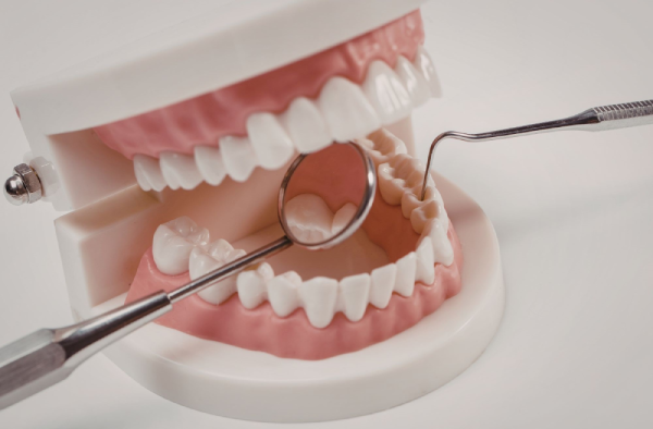 limpieza dental con airflow en Sevilla