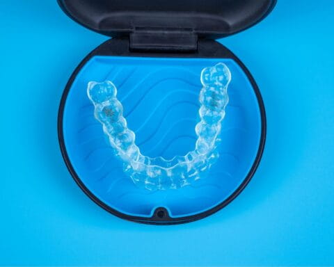 proceso invisalign-inicio del tratamiento proceso invisalign-inicio del tratamiento
